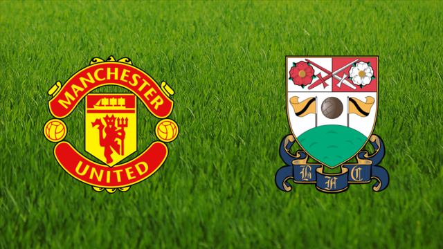 Manchester United vs. Barnet FC